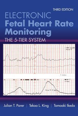 Electronic Fetal Heart Rate Monitoring The 5 Tier System 3Rd