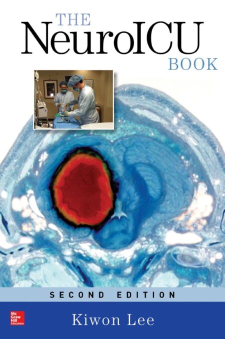 The NeuroICU Book 2nd 2E Kiwon Lee