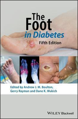 The Foot In Diabetes 5Th