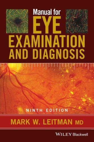 Manual For Eye Examination And Diagnosis 9Th