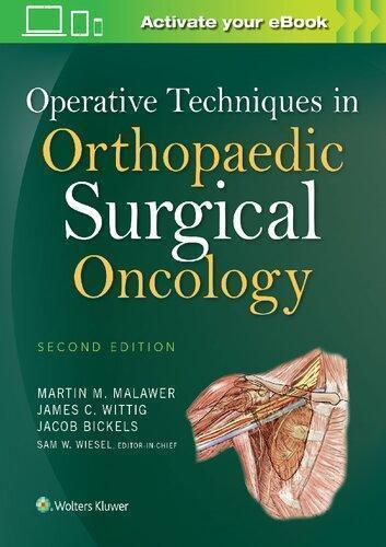 Operative Techniques In Orthopaedic Surgical Oncology 2Nd