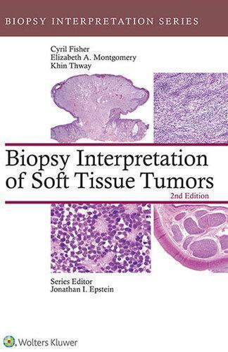 Biopsy Interpretation Of Soft Tissue Tumors 2Nd Biopsy Interpretation Of Soft Tissue Tumors 2Nd