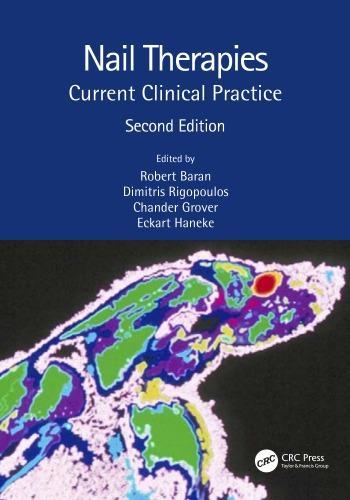 Nail Therapies Current Clinical Practice 2Nd
