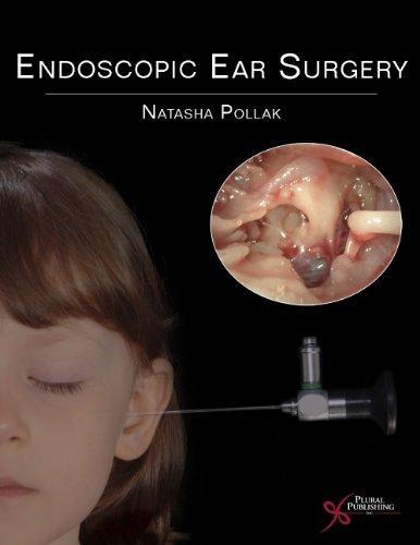Endoscopic Ear Surgery Endoscopic Ear Surgery