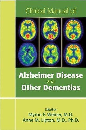 Clinical Manual Of Alzheimer Disease And Other Dementias