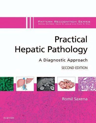 Practical Hepatic Pathology A Diagnostic Approach 2Nd