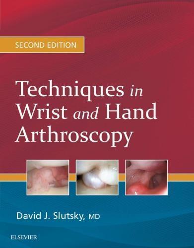 Techniques In Wrist And Hand Arthroscopy 2Nd