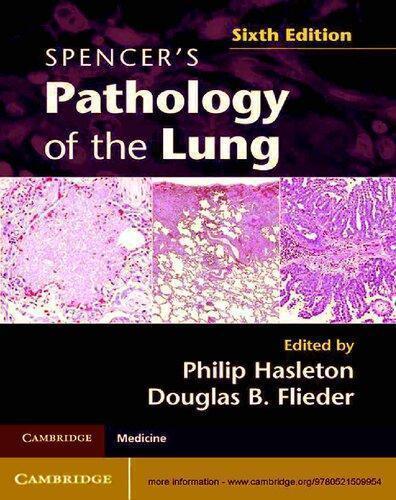 Spencers Pathology Of The Lung 6Th