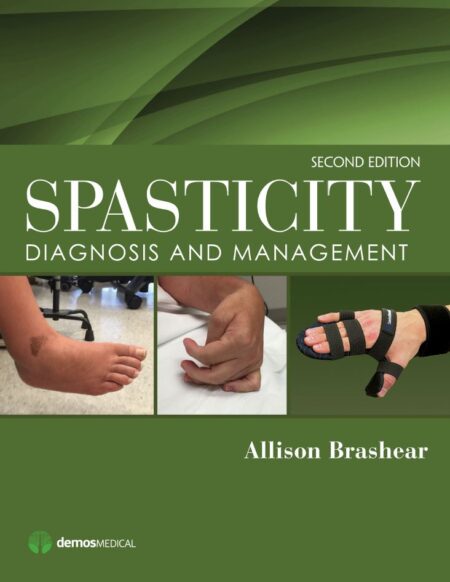Spasticity Diagnosis and Management 2nd 2E
