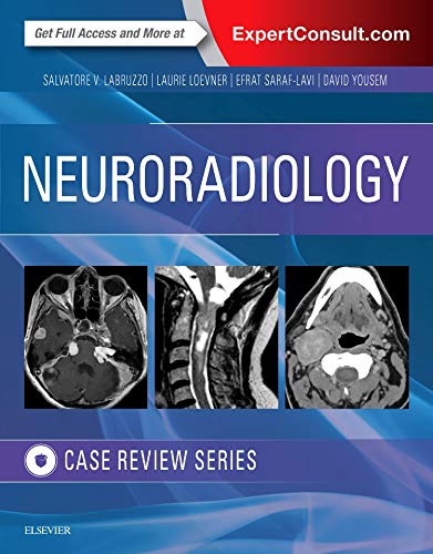 Neuroradiology Imaging Case Review 8211 1st