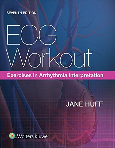 ECG Workout Exercises in Arrhythmia Interpretation 8211 7th