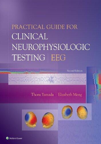 Practical Guide For Clinical Neurophysiologic Testing Eeg 2Nd