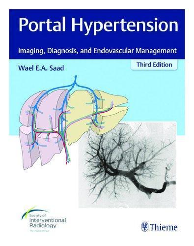 Portal Hypertension Imaging Diagnosis And Endovascular Management 3Rd
