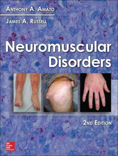 Neuromuscular Disorders 2Nd Amato Neuromuscular Disorders 2Nd Amato