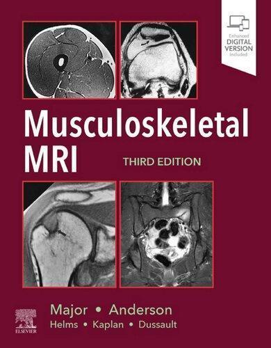 Musculoskeletal Mri 3Rd