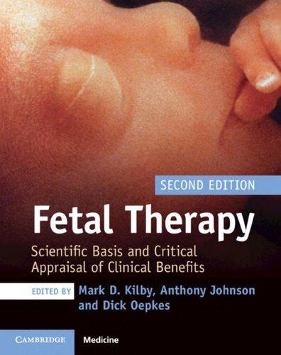 Fetal Therapy Scientific Basis And Critical Appraisal Of Clinical Benefits 2Nd